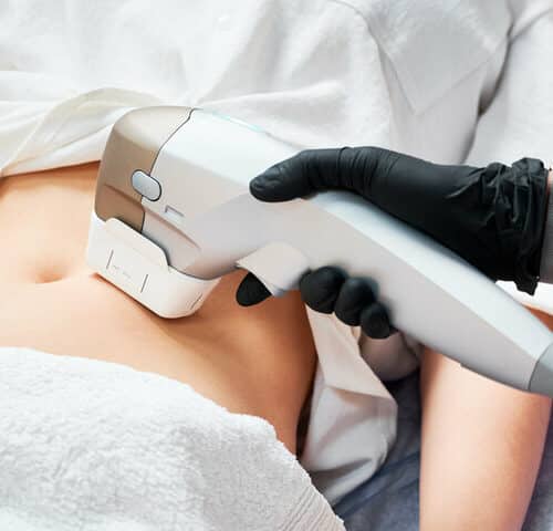 Body Contouring