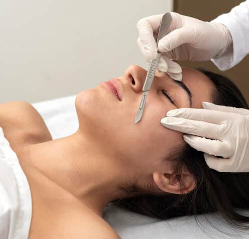  Dermaplaning